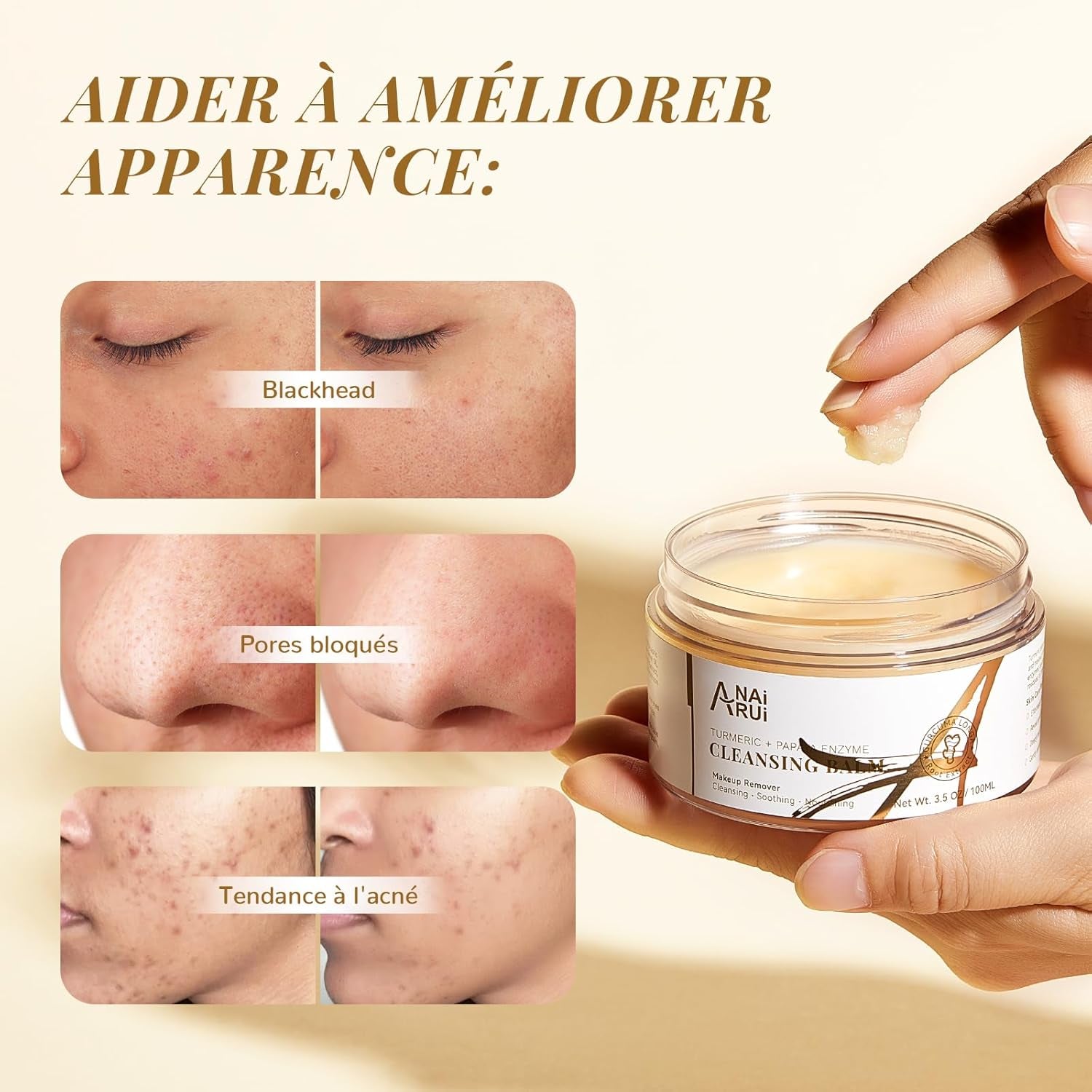 Baume De Nettoyage À La Papaye Au Curcuma, Démaquillant Au Curcuma Pour Le Nettoyage Du Visage, Exfoliant, Réduction Des Taches Brunes, Acné, Peau Lisse, Nettoyant Pour La Peau, 3,5 Oz