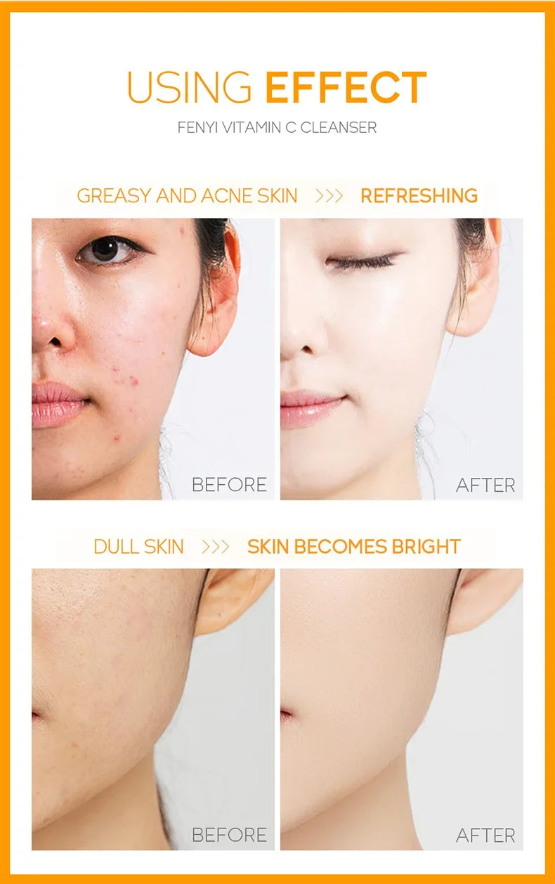 Nettoyant Visage Fleur de Cerisier Japonaise ou Vitamine C - Hydratant Anti-Points Noirs